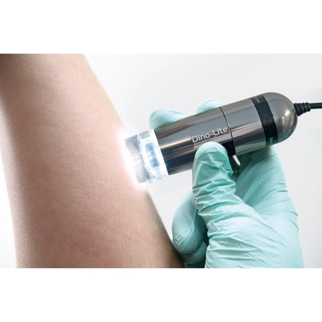 Dino-Lite DermaScope 5Mpx, 10-70 & 200x 