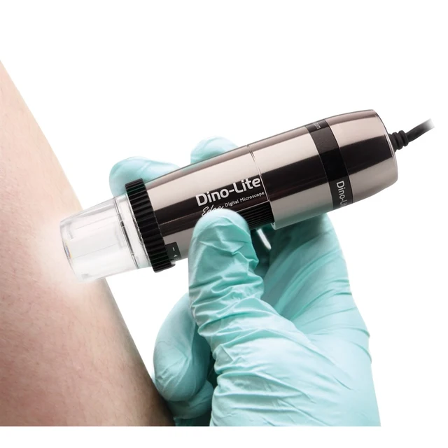 Dino-Lite DermaScope 5Mpx, POLA, HR 