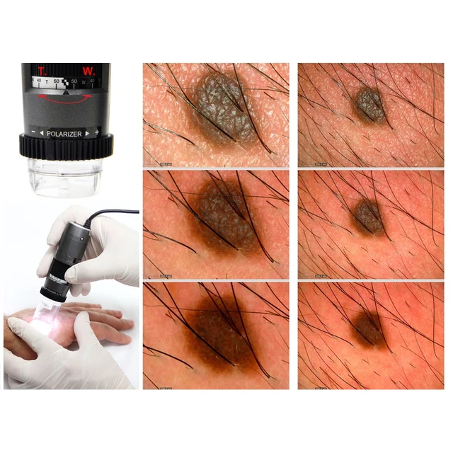 Dino-Lite DermaScope 1,3Mpx 10-50x, POLA 