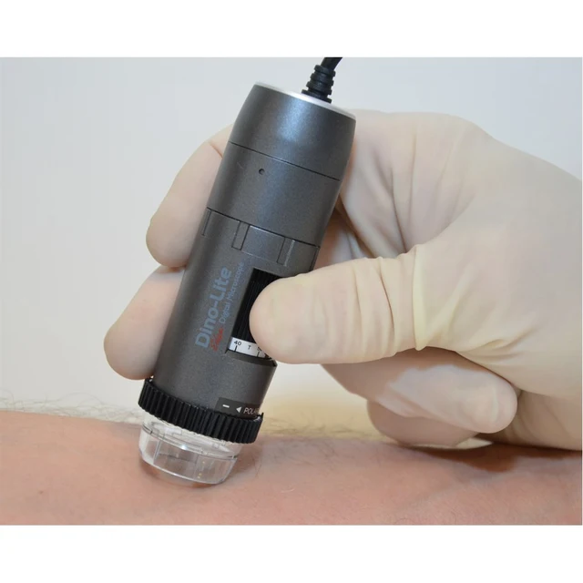 Dino-Lite DermaScope 1,3Mpx 10-50x, POLA 