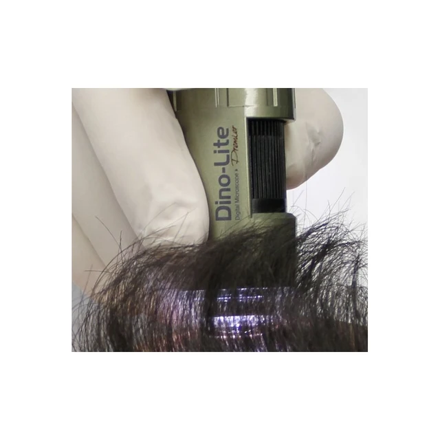 Dino-Lite TrichoScope 1,3Mpx 10-70 & 200x, POLA 