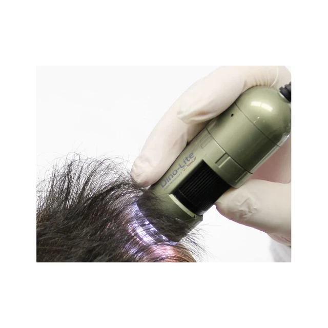 Dino-Lite TrichoScope 1,3Mpx 10-70 & 200x, POLA 