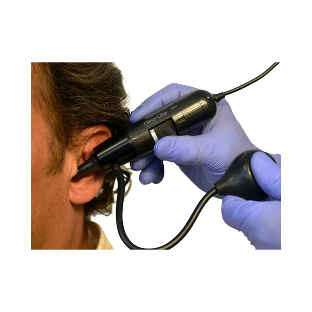 Dino-Lite EarScope Pneumatic 1,3Mpx 55-90x 