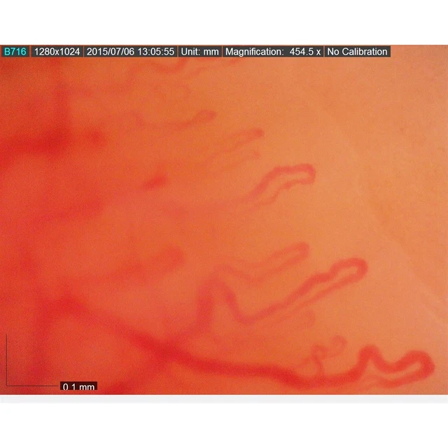 Dino-Lite CapillaryScope 500 1,3Mpx 500x, 